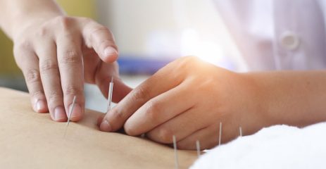 garuda health acupuncture Garuda Health Acupuncture